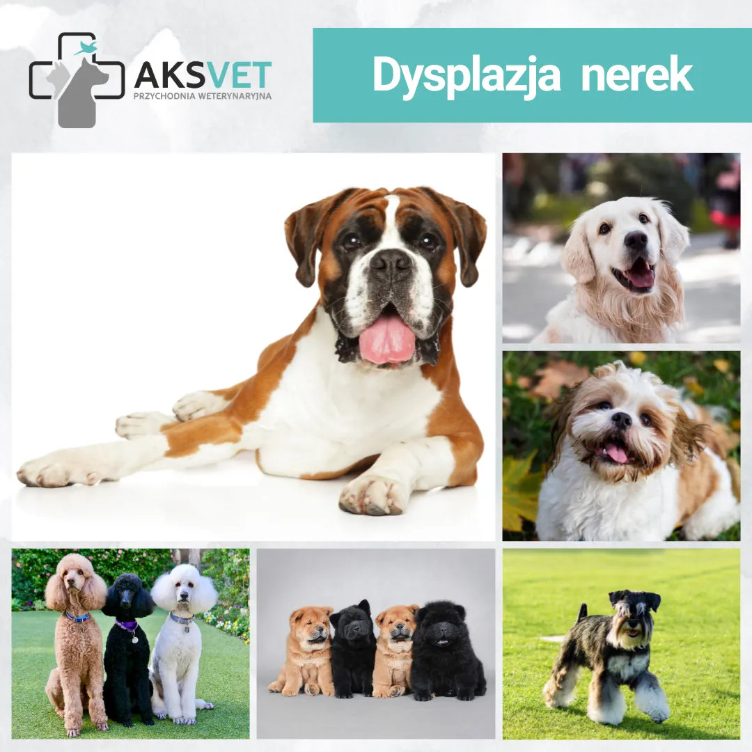 Dysplazja nerek